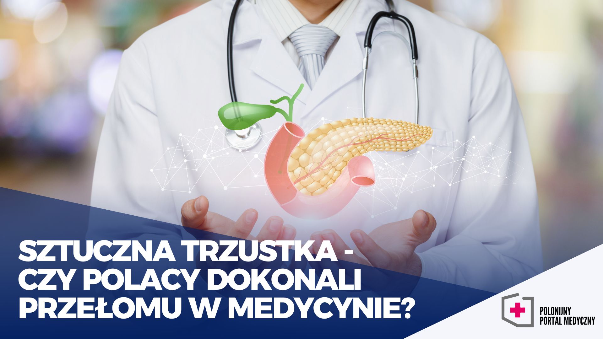 Sztuczna Trzustka Czy Polacy Dokonali Przełomu W Medycynie Polonijny Portal Medyczny 6046